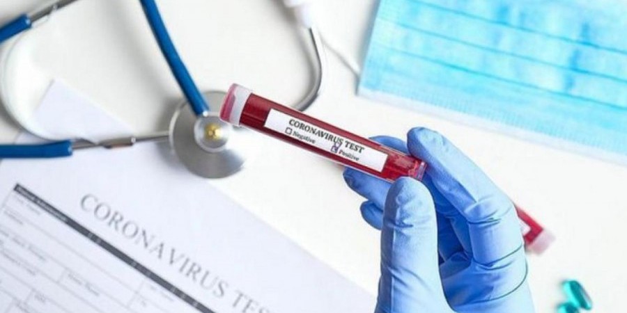Δύο νεκροί και 527 νέα κρούσματα κορονοϊού στην Κύπρο thumb
